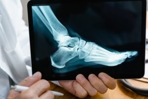 Orthopedic